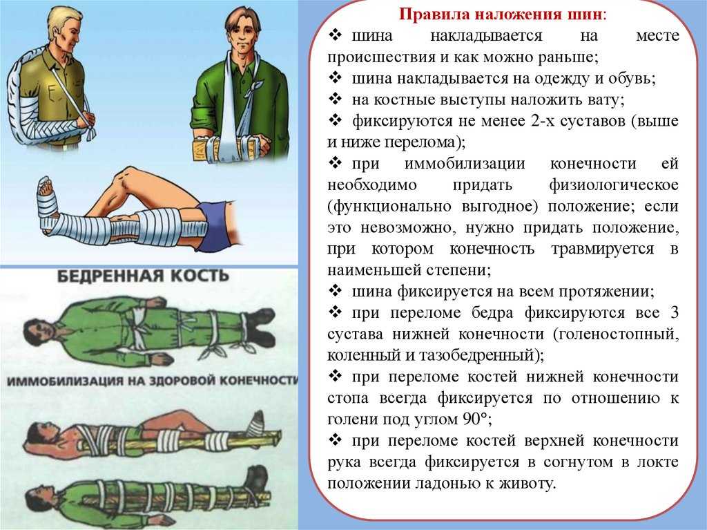 Шины при переломах: виды и правила наложения