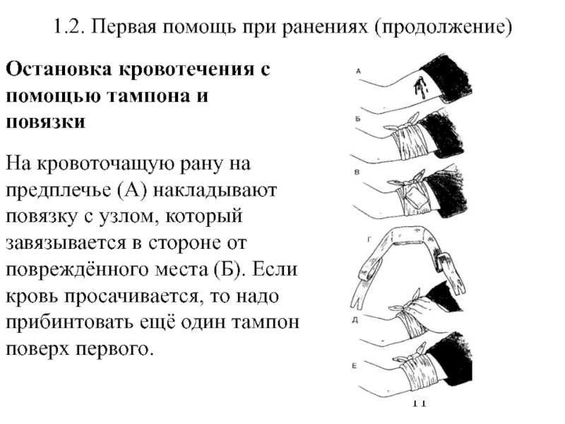 Оказание первой помощи при переломах: правила иммобилизации — российско — армянский центр гуманитарного реагирования