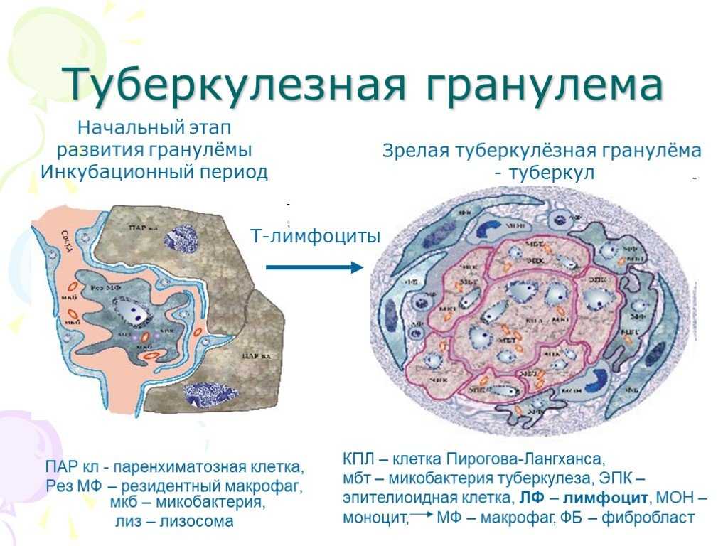 Грануляция раны - что это такое и какие виды грануляций существуют