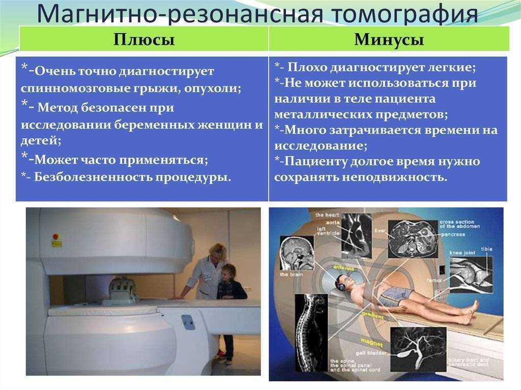 Результаты использования каркасного ксеноперикардиального биопротеза с системой "easy change" в аортальной позиции: 12 мес после имплантации