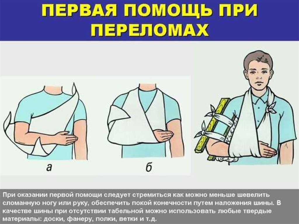 Шина при переломах: как накладывается, правила наложения и фиксации при открытом и закрытом переломе