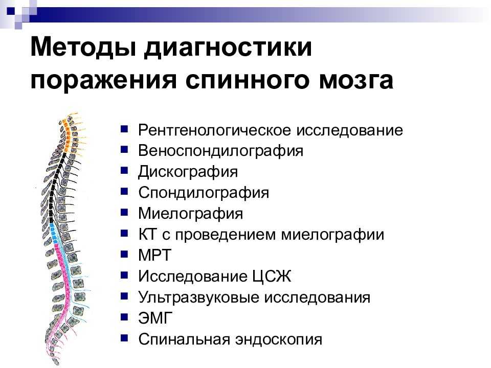 Миофасциальная боль - лечение, симптомы, причины, диагностика | центр дикуля