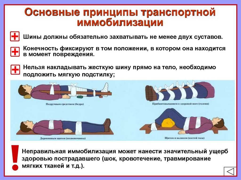Как наложить шину при переломе, простые правила