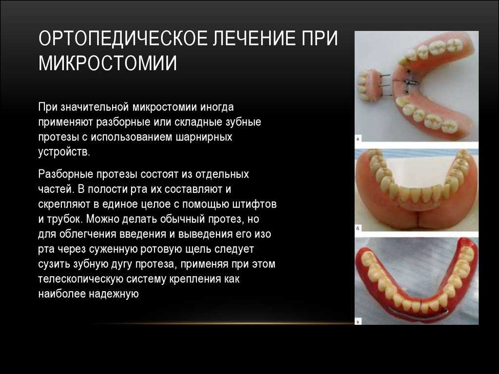 Технология изготовления шины вебера. съемные лабораторные шины