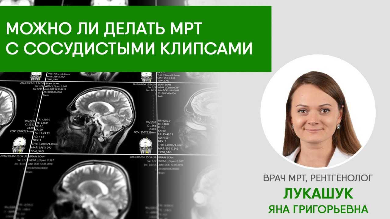 Все противопоказания к мрт - абсолютные и относительные