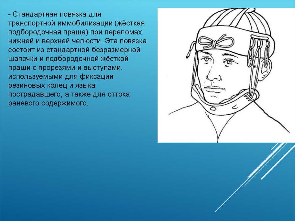 Переломы челюстей — классификация переломов челюстей