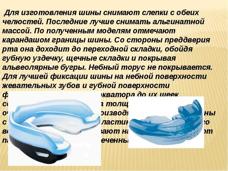 Капа боксерская — необходимая часть экипировки спортсмена