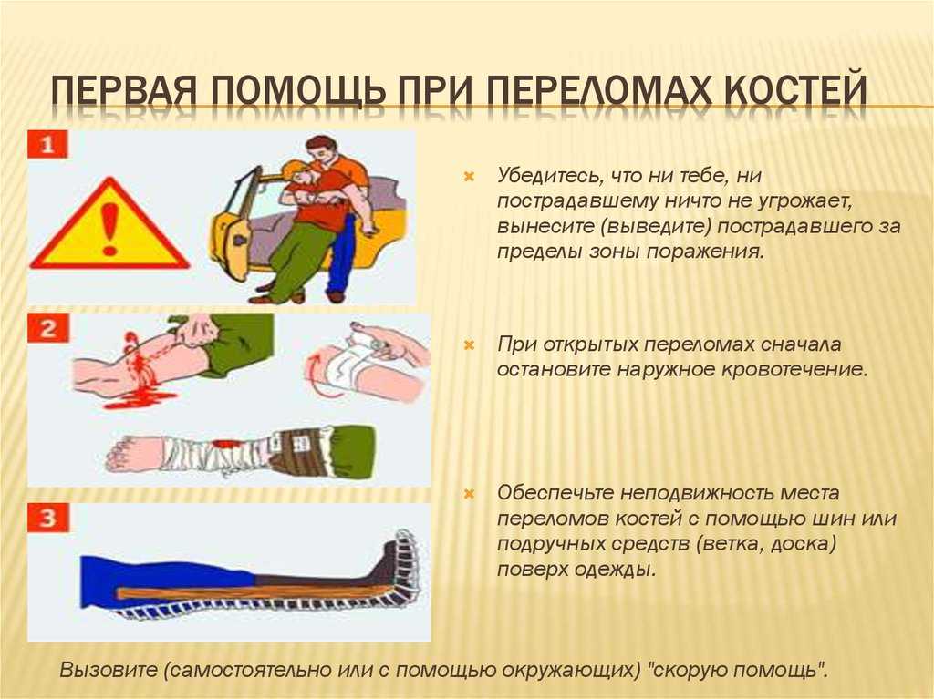 Виды переломов и их классификация
