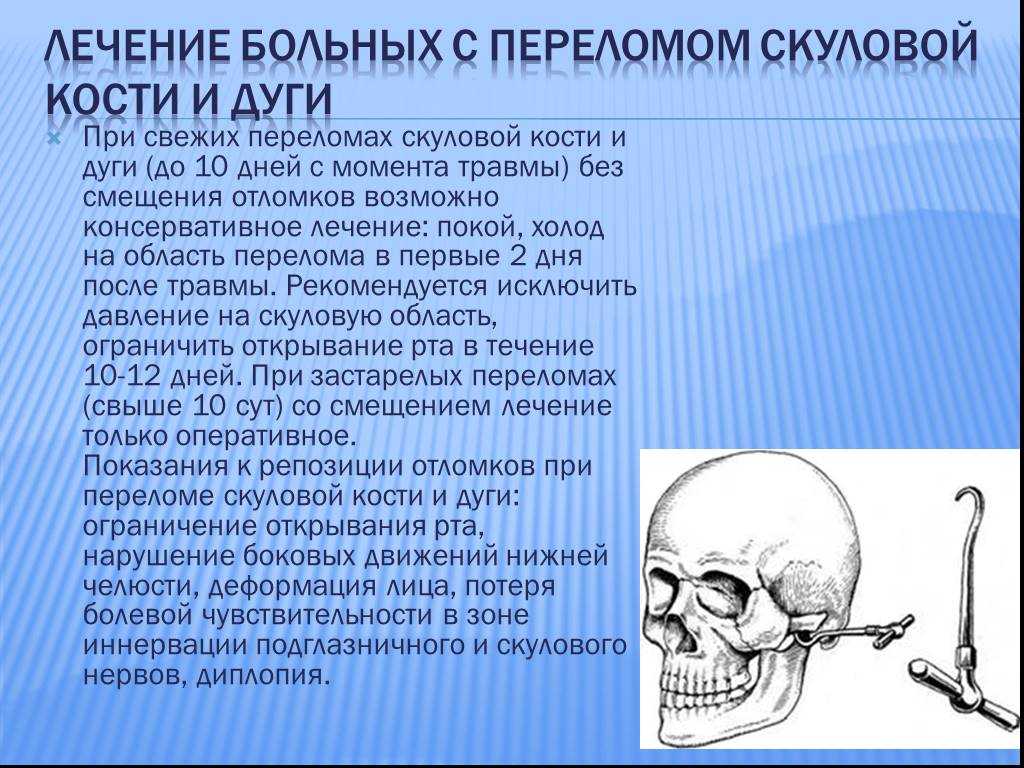 Как определить перелом нижней челюсти?
                            229