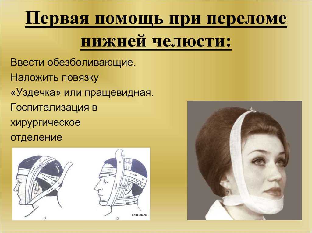 Методы ретенции челюстно лицевых и лицевых протезов. челюстно-лицевая ортопедия и протезирование